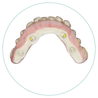 fibra+de+vidrio+dental (1)